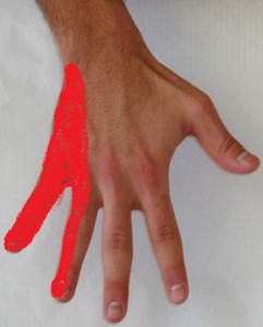 Ulnar Nerve Damage Diagnosis